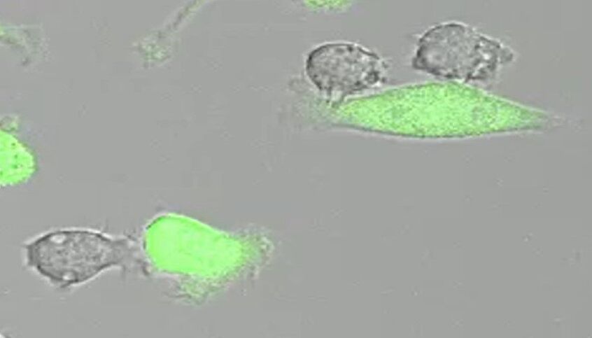 Macrophages (grey) attacking tumor cells (green) © Manfred Ogris, Magdalena Billerhart, University of Vienna